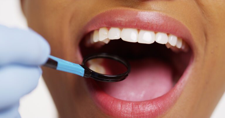 Dental Treatments You Should Help Your Kids Prepare For